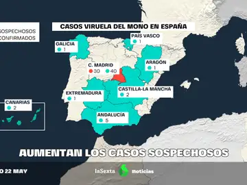 Aragón confirma su primer caso sospechoso de viruela del mono