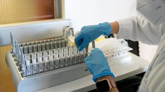 Una sanitaria prepara las probetas en un laboratorio, en una fotografía de archivo. Una sanitaria prepara las probetas en un laboratorio, en una fotografía de archivo.