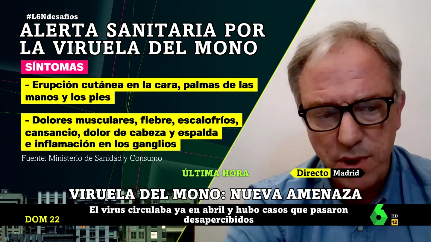 El doctor Juan Armengol detalla las diferencias entre el COVID-19 y el brote de viruela del mono El doctor Juan Armengol detalla las diferencias entre el COVID-19 y el brote de viruela del mono