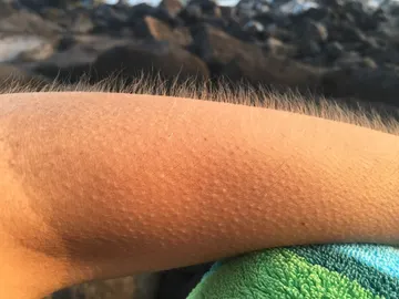 Pelos de punta Pelos de punta