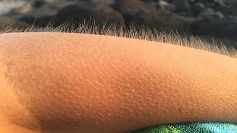 Pelos de punta Pelos de punta