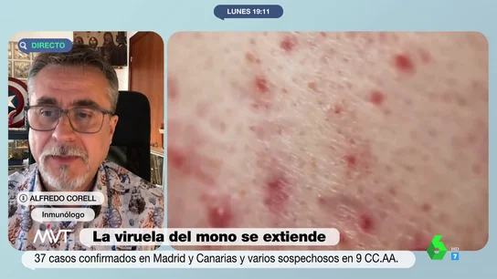 Alfredo Corell desmonta la teoría de la conspiración sobre el origen del brote de viruela del mono y explica cómo pudo surgir Alfredo Corell desmonta la teoría de la conspiración sobre el origen del brote de viruela del mono y explica cómo pudo surgir