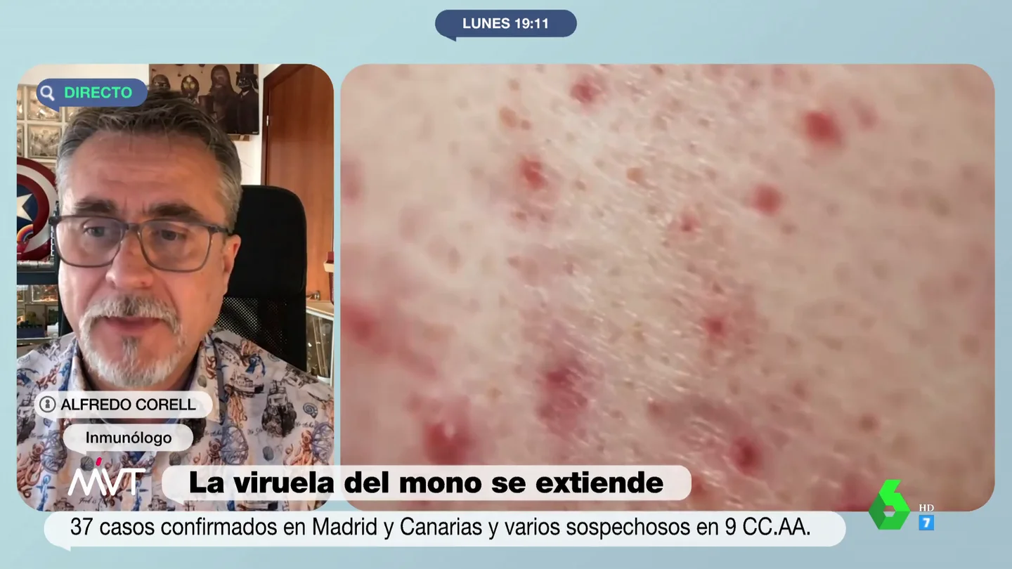 Alfredo Corell desmonta la teoría de la conspiración sobre el origen del brote de viruela del mono y explica cómo pudo surgir Alfredo Corell desmonta la teoría de la conspiración sobre el origen del brote de viruela del mono y explica cómo pudo surgir