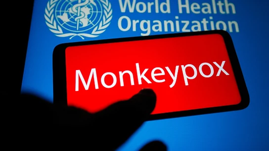 ¿Cuál es el período de incubación de la viruela del mono? la OMS responde ¿Cuál es el período de incubación de la viruela del mono? la OMS responde