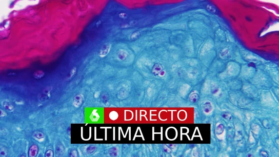 Viruela del mono, última hora: brote, vacuna y los nuevos contagios en España, en directo Viruela del mono, última hora: brote, vacuna y los nuevos contagios en España, en directo