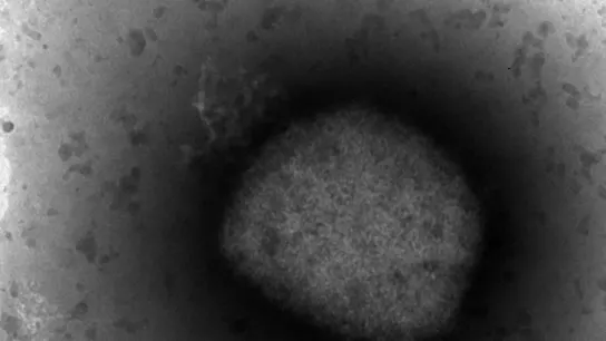 Imagen microscópica del virus causante de la viruela del mono Imagen microscópica del virus causante de la viruela del mono