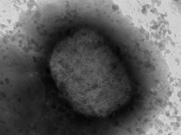 Obtienen la secuencia del 100 del genoma del virus de la viruela del mono Obtienen la secuencia del 100 del genoma del virus de la viruela del mono