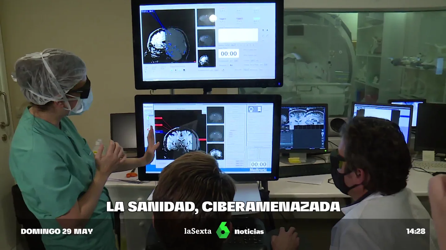 La sanidad ciberamenazada: "Modificar una imagen médica, insertando un tumor donde no lo hay, puede ser un problema importante" Información de alto nivel