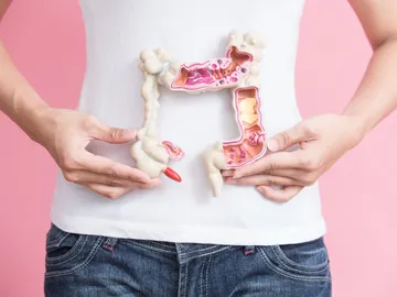 Cáncer colorrectal Cáncer colorrectal