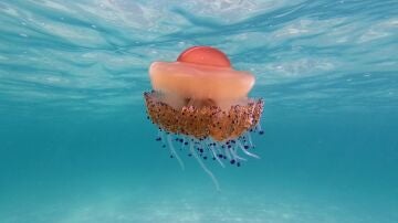 Qué hacer en caso de picadura de medusa