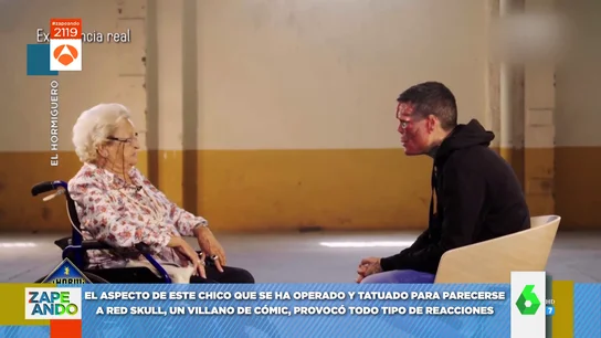 Así reaccionan niños y abuelos al ver el rostro de un joven tras operarse para parecerse a un villano de cómic: "No está bien de la cabeza" Así reaccionan niños y abuelos al ver el rostro de un joven tras operarse para parecerse a un villano de cómic: "No está bien de la cabeza"