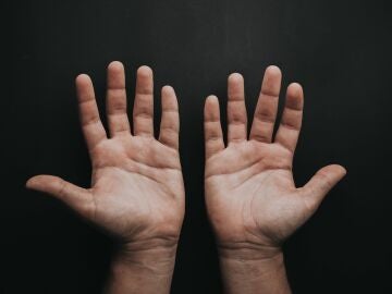 Dedos de las manos