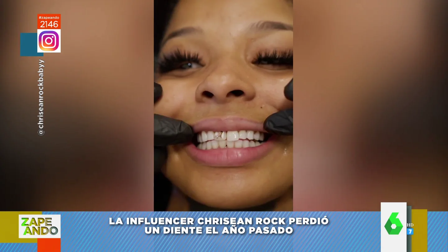 Chrisean Rock se pone un diente con la cara de su novio Chrisean Rock se pone un diente con la cara de su novio