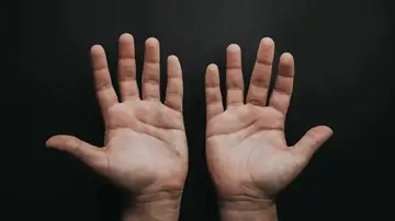 extremidades manos