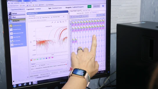 Un laboratorio analiza muestras de viruela del mono Un laboratorio analiza muestras de viruela del mono