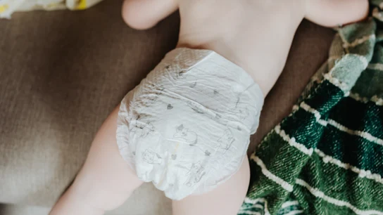 El bebé contagiado de viruela del mono en Madrid tiene "buena evolución clínica" Estaba vacunado
