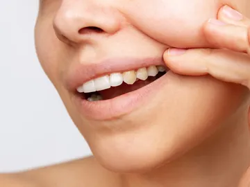Dientes oscuros Dientes oscuros
