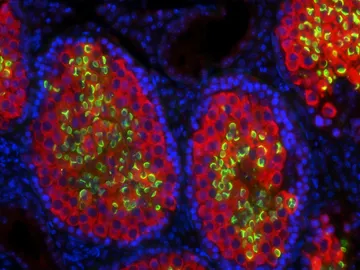 Testículo de quimera ratón-rata al microscopio Testículo de quimera ratón-rata al microscopio