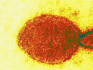 Henipavirus Henipavirus