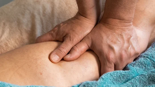 Qué es un lipedema Qué es un lipedema