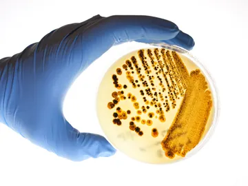 Bacterias Bacterias