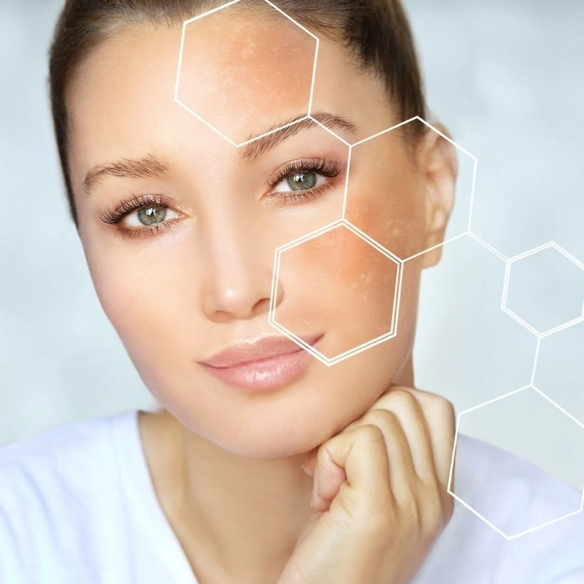 Cómo eliminar las manchas la cara? 3 tratamientos recomendados por los dermatólogos