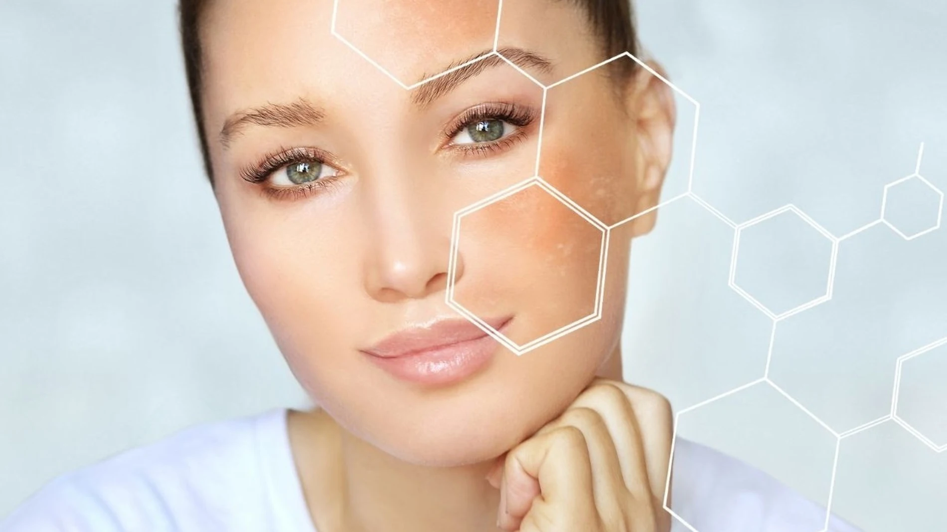 Cómo las manchas de la cara? 3 tratamientos recomendados por los dermatólogos