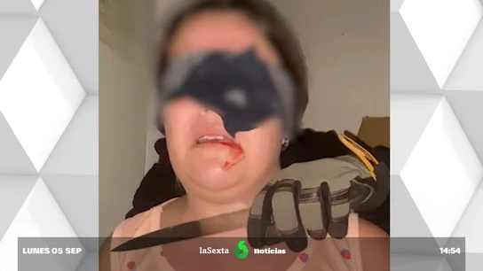 Detenida una joven en Tenerife por simular su secuestro y pedir a su madre 50.000 euros de rescate Detenida una joven en Tenerife por simular su secuestro y pedir a su madre 50.000 euros de rescate