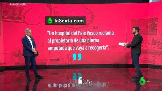 Preguntas y respuestas si te amputan un miembro: ¿le puedes hacer un velatorio? ¿Puedes deshacerte de él? Preguntas y respuestas si te amputan un miembro: ¿le puedes hacer un velatorio? ¿Puedes deshacerte de él?