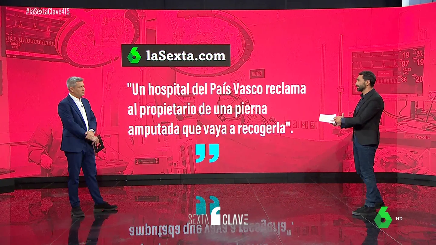 Preguntas y respuestas si te amputan un miembro: ¿le puedes hacer un velatorio? ¿Puedes deshacerte de él? Preguntas y respuestas si te amputan un miembro: ¿le puedes hacer un velatorio? ¿Puedes deshacerte de él?