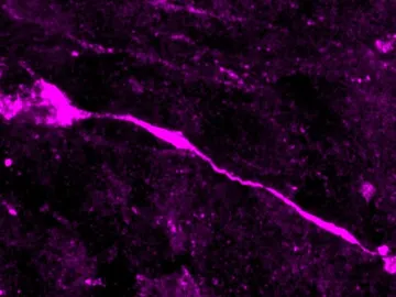 célula glial radial basal en división célula glial radial basal en división