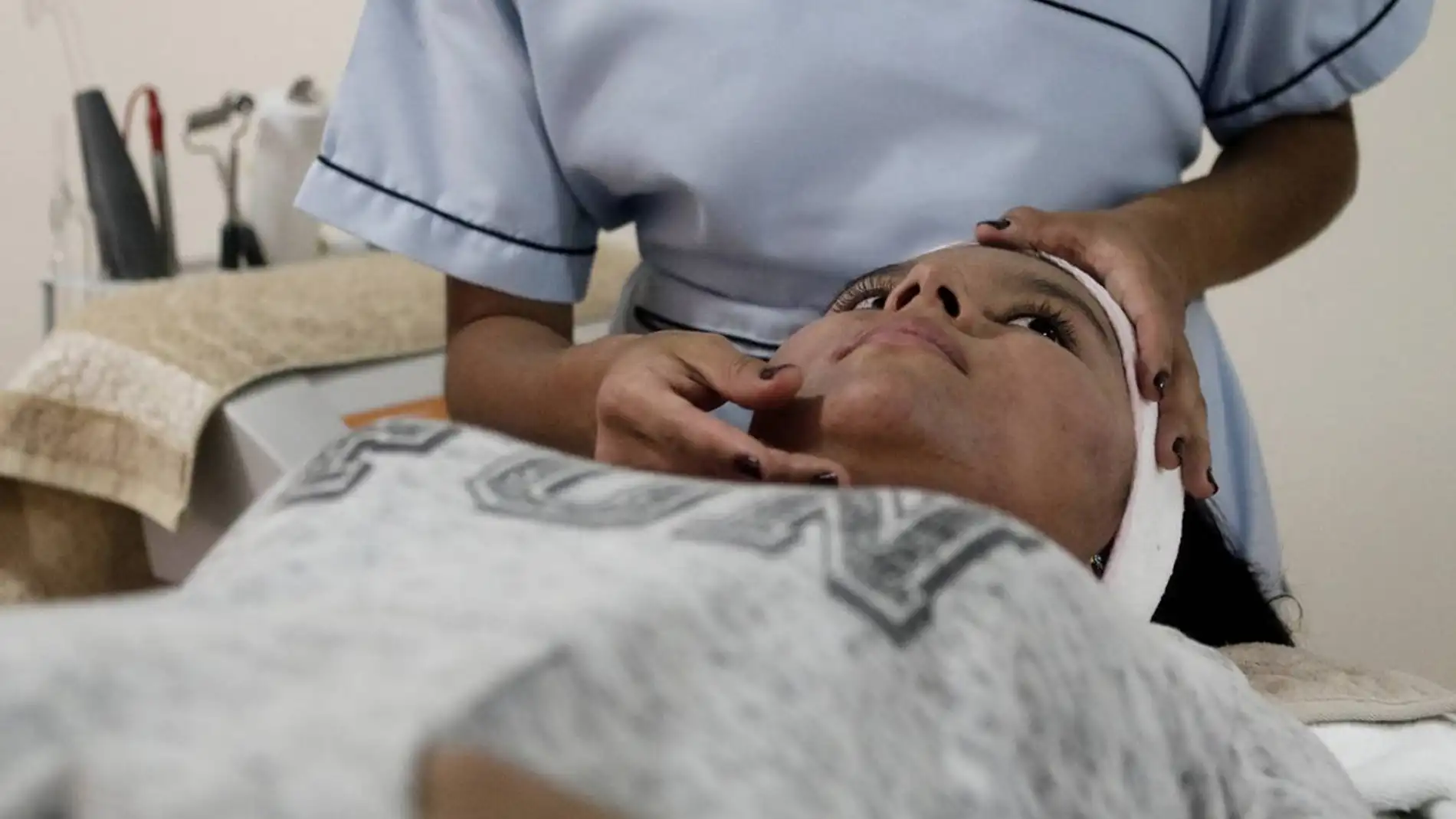 paciente con lupus paciente con lupus