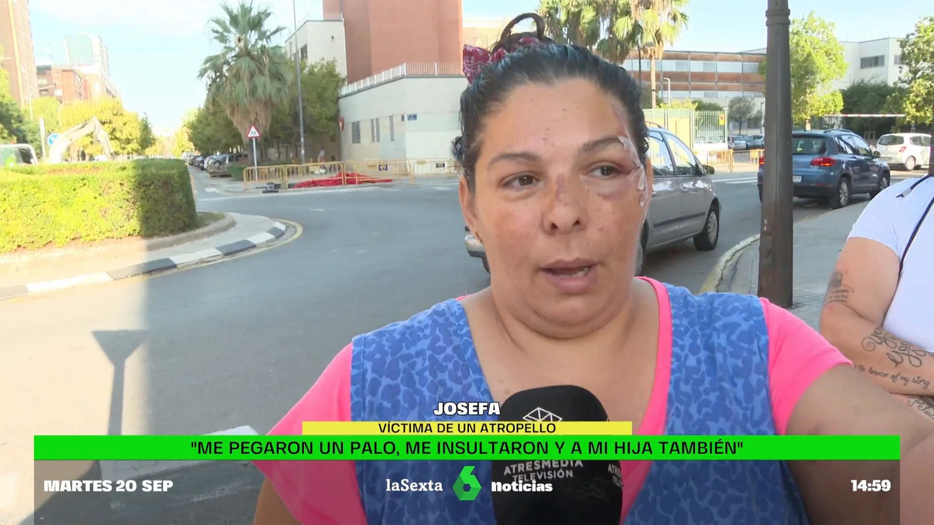 Josefa, atropellada por su yerno
