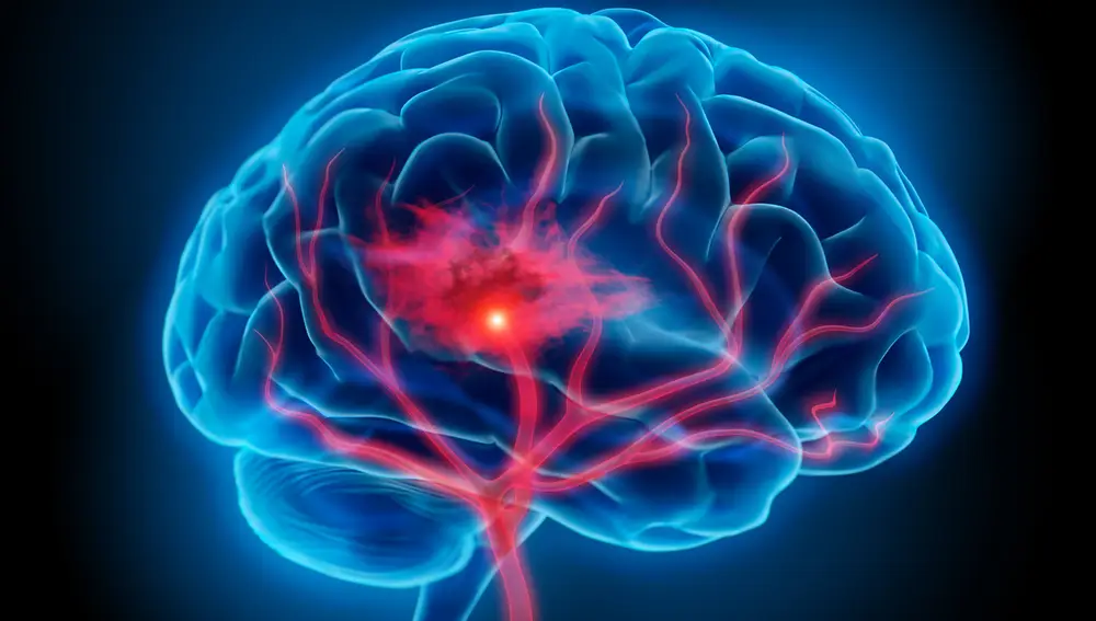 Cerebro humano Cerebro humano