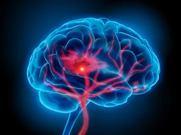 Cerebro humano Cerebro humano