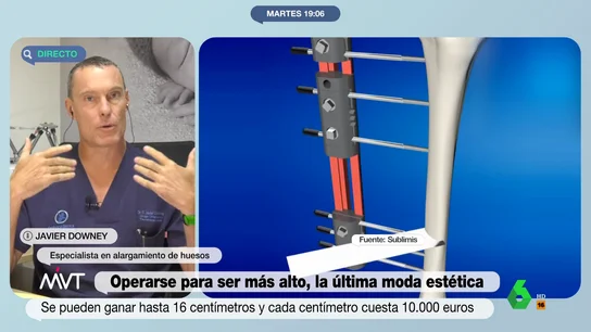 El cirujano Javier Downey explica cómo es la operación estética para ser más alto y cuáles son sus inconvenientes El cirujano Javier Downey explica cómo es la operación estética para ser más alto y cuáles son sus inconvenientes