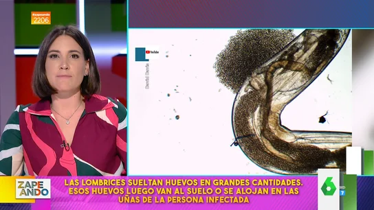 ¿Cómo se transmiten las lombrices? Boticaria García explica cómo se quedan en las uñas o entran en la nariz o la boca ¿Cómo se transmiten las lombrices? Boticaria García explica cómo se quedan en las uñas o entran en la nariz o la boca
