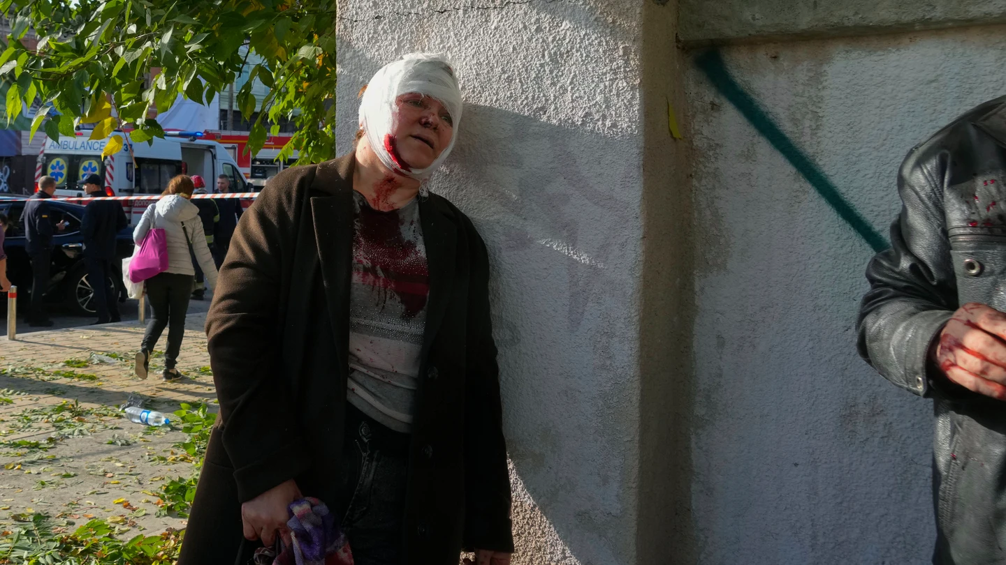 Una mujer herida después de un bombardeo ruso en Kiev, Ucrania. Una mujer herida después de un bombardeo ruso en Kyiv, Ucrania.
