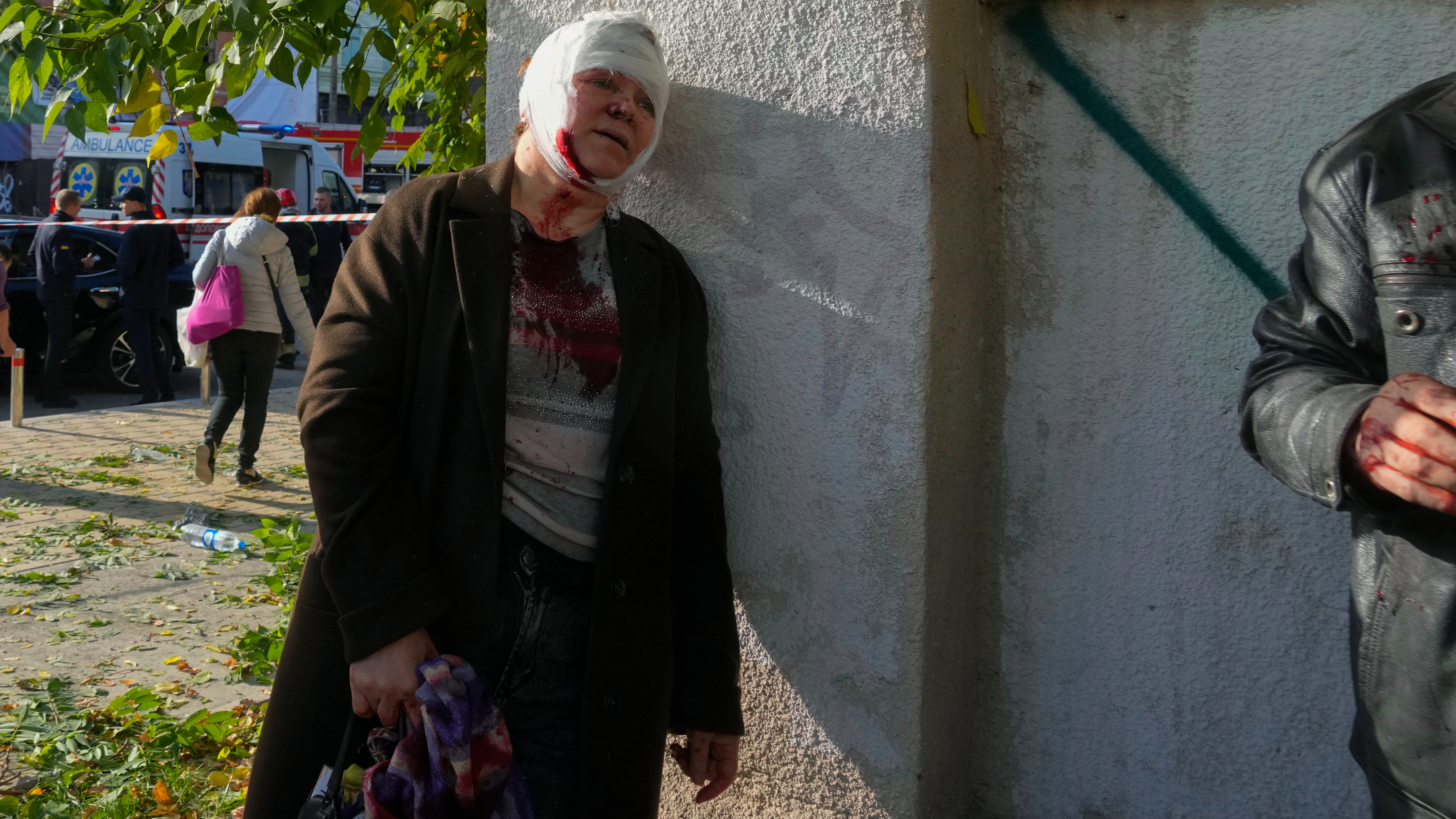 Una mujer herida después de un bombardeo ruso en Kyiv, Ucrania.