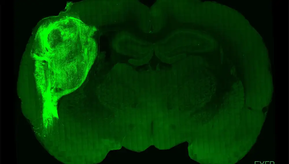 Un organoide humano trasplantado y marcado con una proteína fluorescente en una sección del cerebro de la rata