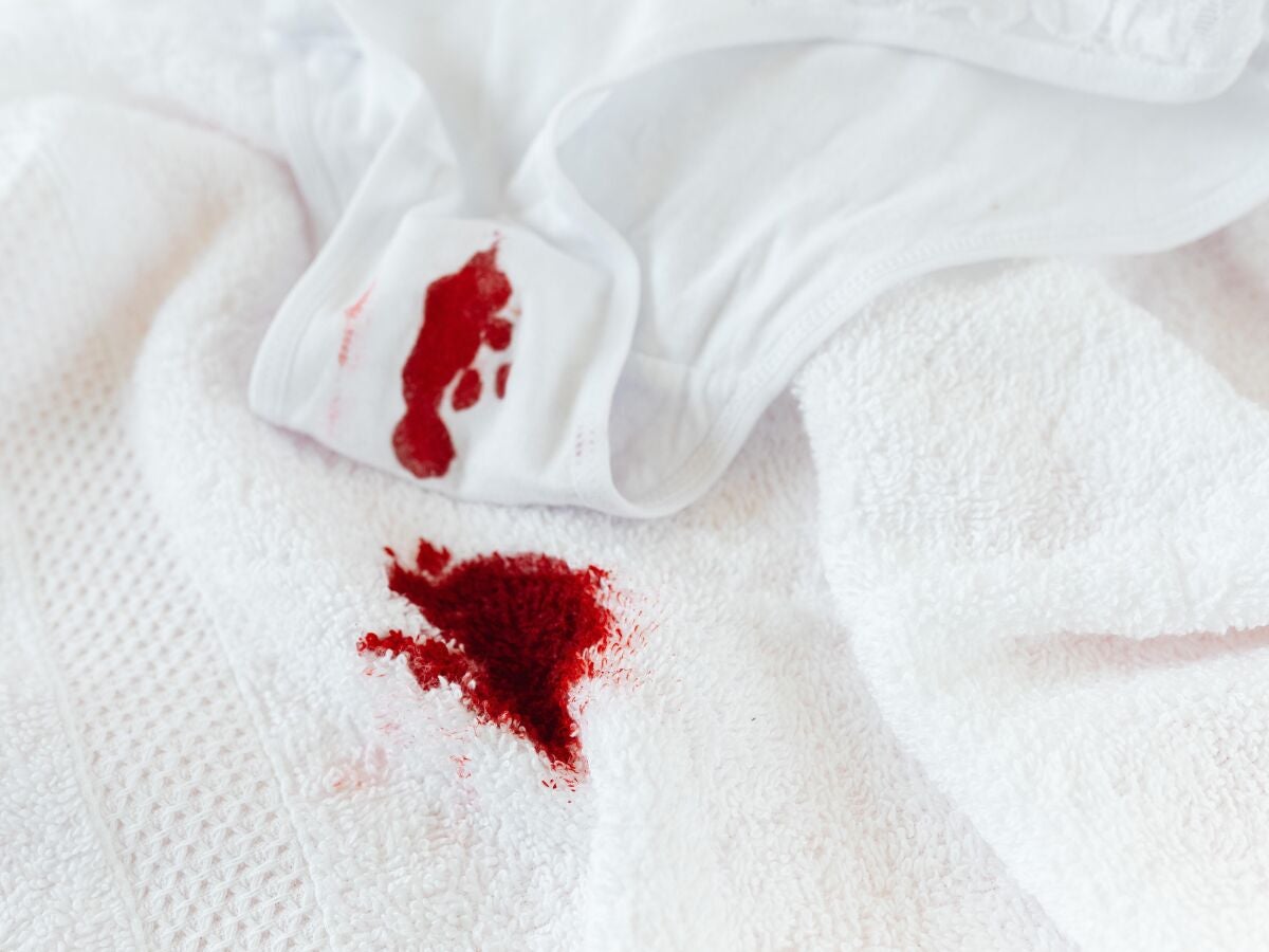 Como quitar manchas de sangre deals seca de la ropa blanca