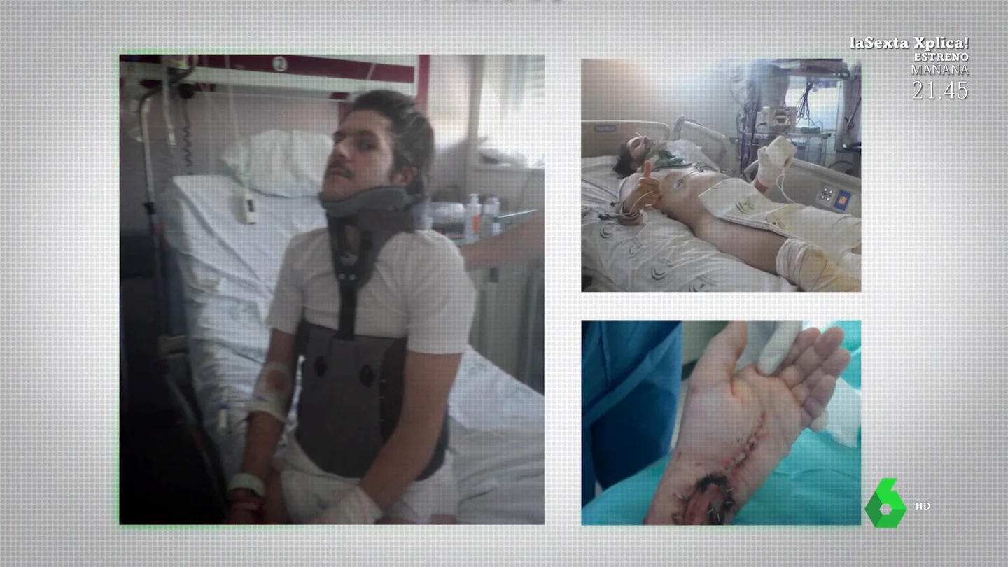 "Estuve a punto de morir y falsearon el registro de horas": el estremecedor caso de un camarero que sufrió un accidente laboral "Estuve a punto de morir y falsearon el registro de horas": el estremecedor caso de un camarero que sufrió un accidente laboral