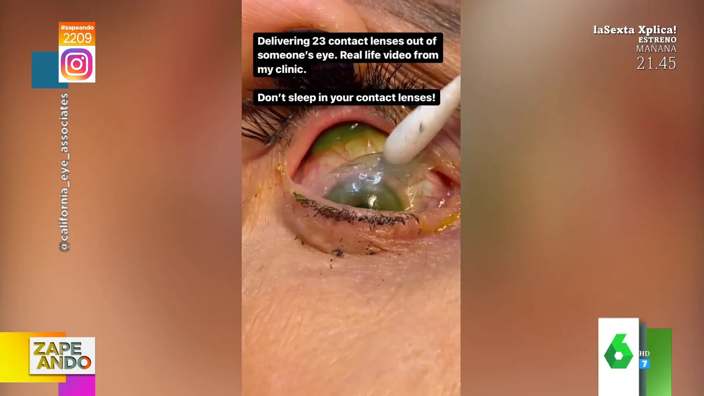 lentillas lentillas