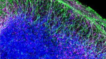 Microscopía de los organoides