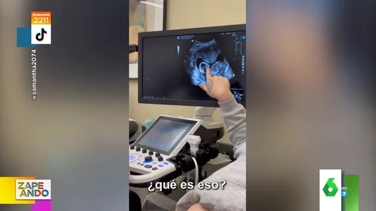 El vídeo en el que una alumna descubre que está embarazada al aprender a hacer ecografías : "¿Qué es eso?" El vídeo en el que una alumna descubre que está embarazada al aprender a hacer ecografías : "¿Qué es eso?"