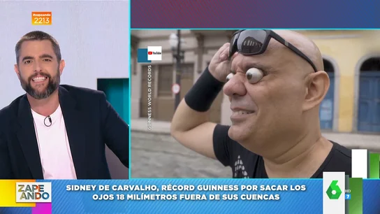 Conoce a Sidney, el hombre que es capaz de sacar 18 milímetros sus ojos de las órbitas Conoce a Sidney, el hombre que es capaz de sacar 18 milímetros sus ojos de las órbitas