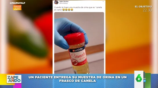 Un paciente usa un bote de canela para entregar una muestra de orina al médico Un paciente usa un bote de canela para entregar una muestra de orina al médico
