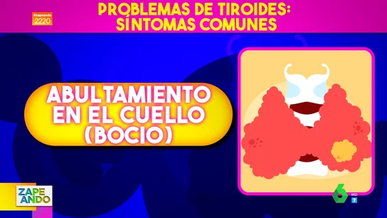 Boticaria García explica qué síntomas sufres si tienes problemas de tiroides: de un abultamiento en el cuello a cambios de peso Boticaria García explica qué síntomas sufres si tienes problemas de tiroides: de un abultamiento en el cuello a cambios de peso