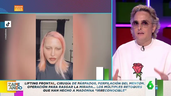 Josie habla sobre las operaciones estéticas de Madonna Josie habla sobre las operaciones estéticas de Madonna