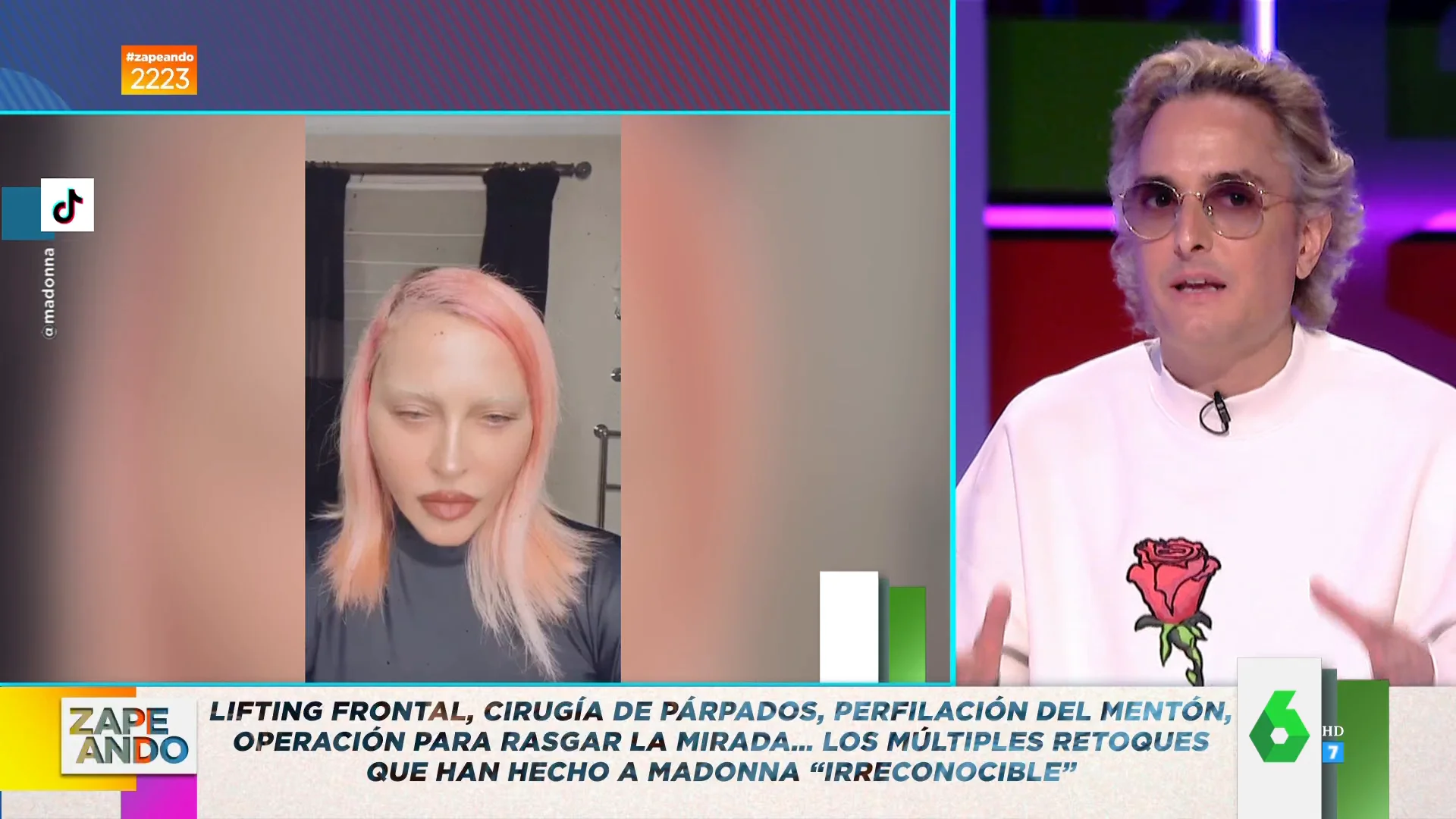 Josie habla sobre las operaciones estéticas de Madonna